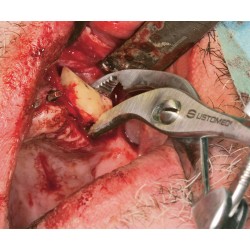 Ustomed NENTWIG Forceps para fijación osea