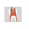 802L-FG Fresa endodoncia redonda larga con cuello