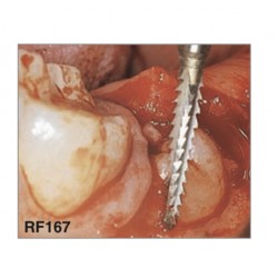 RF167 LINDEMANN Fresa de acero quirúrgica para cirugía de hueso