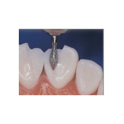 SG886-FG Fresa diamanda  grano super grueso  con forma de cilindro con punta